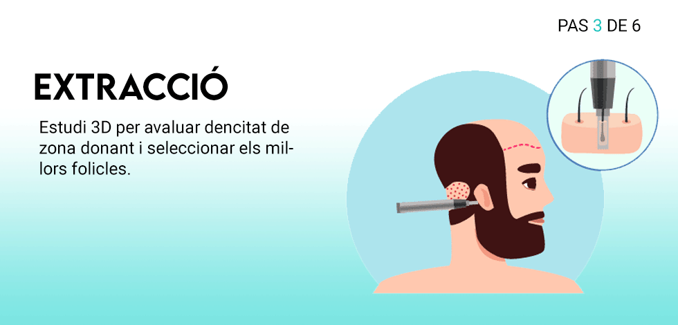 tecnica_3_cat