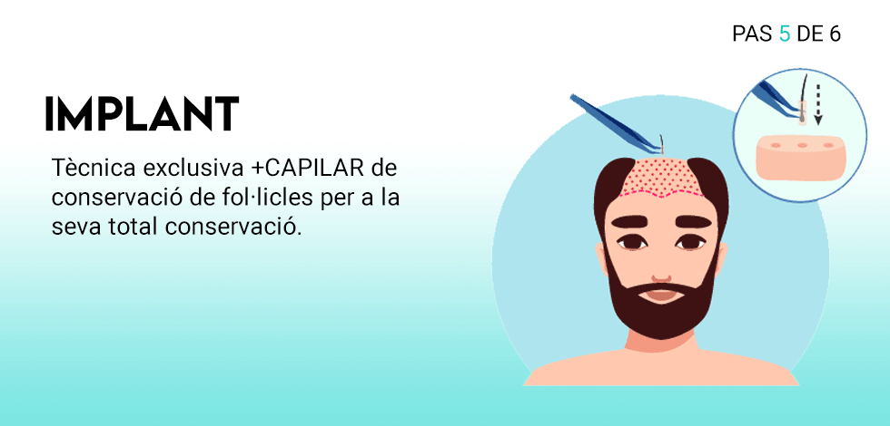 tecnica_5_cat